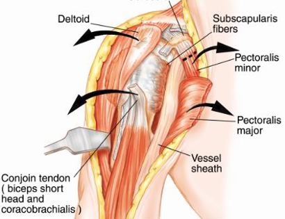 Muscle releases 