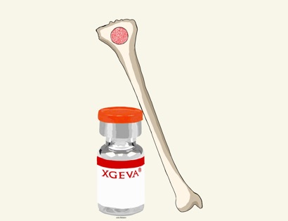 Bisphosphonates