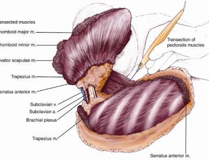 dissection 